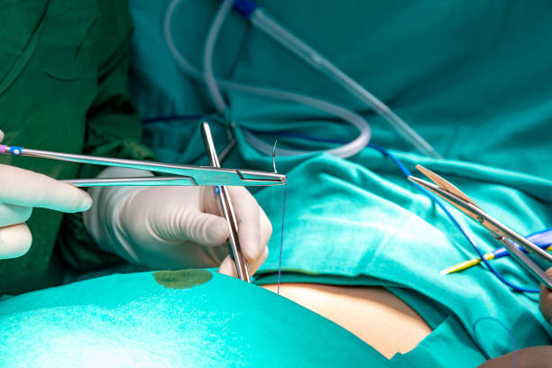 Infeksi Luka Pascaoperasi